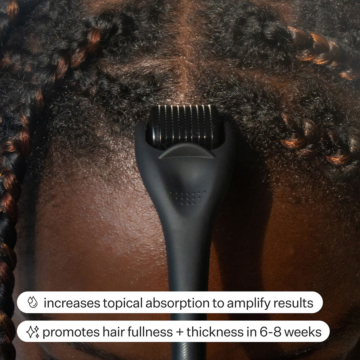 Act+Acre Dermaroller Hair System