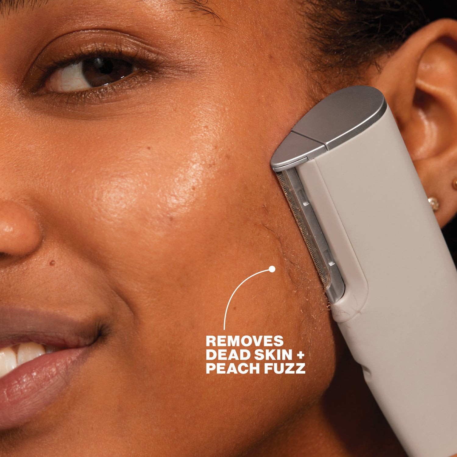 Dermaflash Luxe+