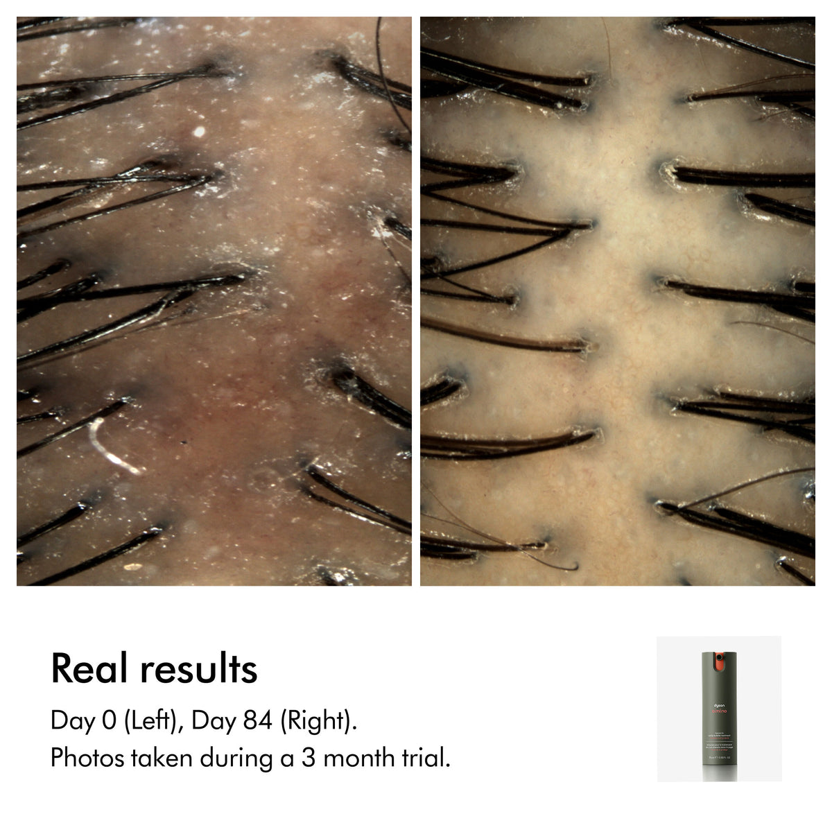 Before and after results of using Dyson Amino Balance & Strengthen Scalp Treatment for Fuller Looking Hair