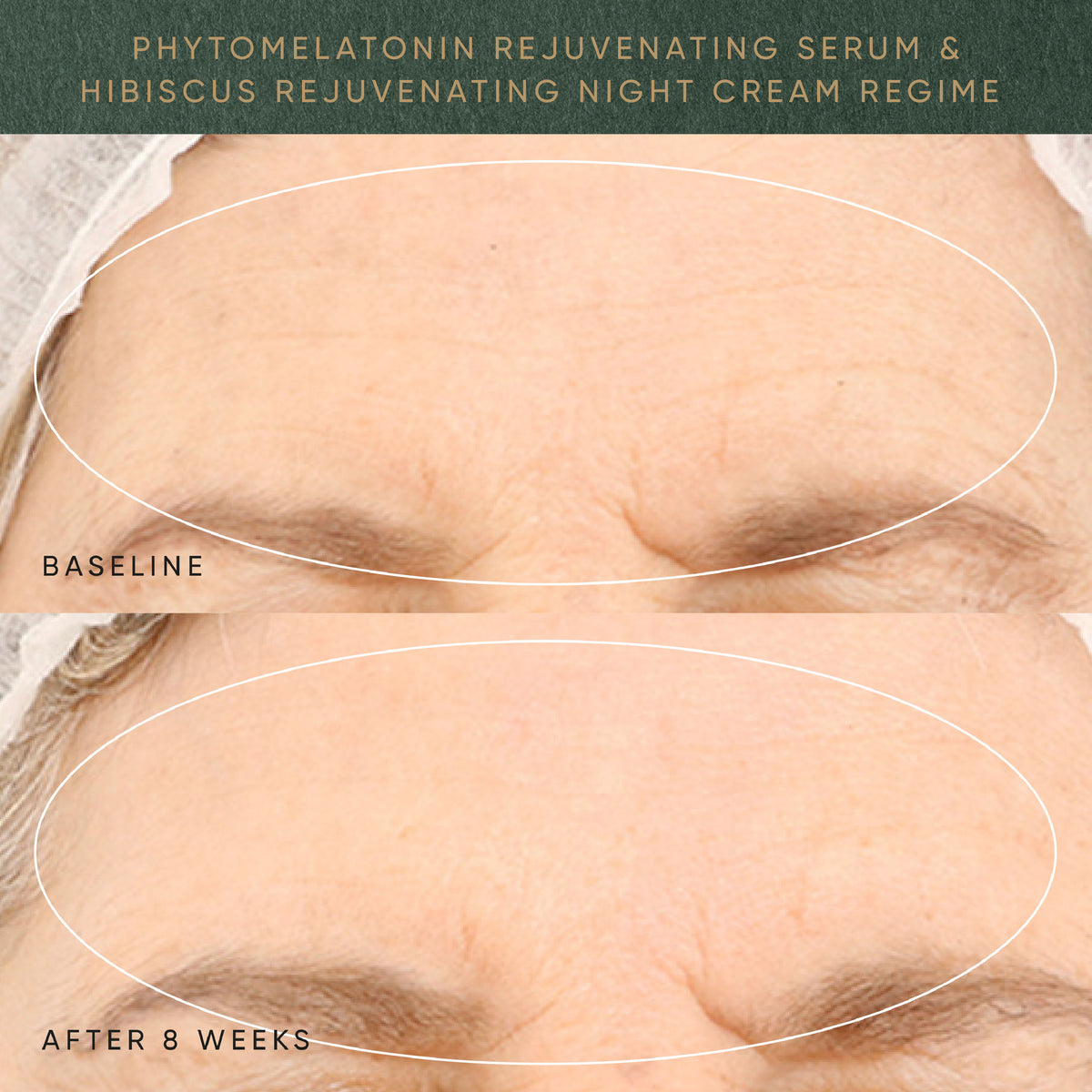 Before and after results of using Irene Forte Irene's Rejuvenating Night Routine Kit (Limited Edition)