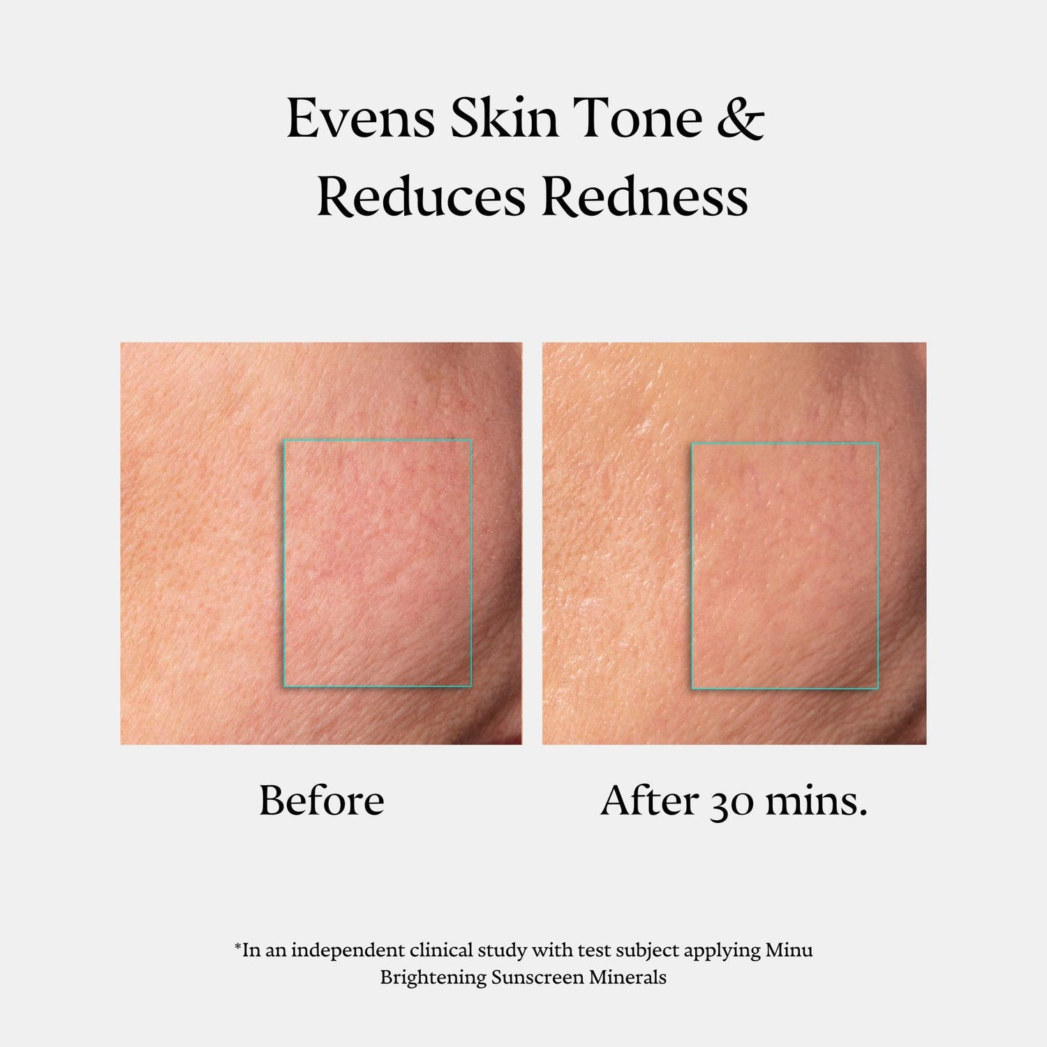 Before and after results of using Minu Brightening Sunscreen Minerals Broad Spectrum SPF 30 Gel-Cream