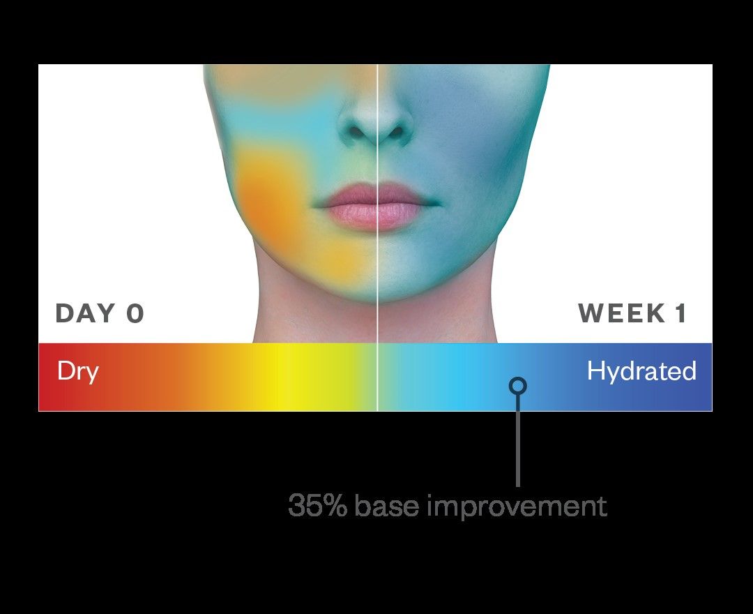 Before and after results of using SkinMedica HA5 Hydra-Collagen Replenish + Restore Hydrator