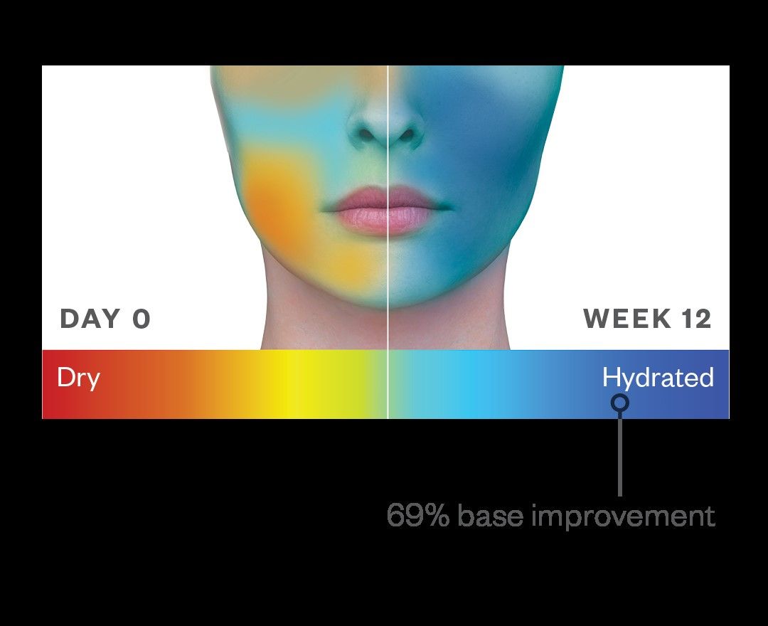 Before and after results of using SkinMedica HA5 Hydra-Collagen Replenish + Restore Hydrator