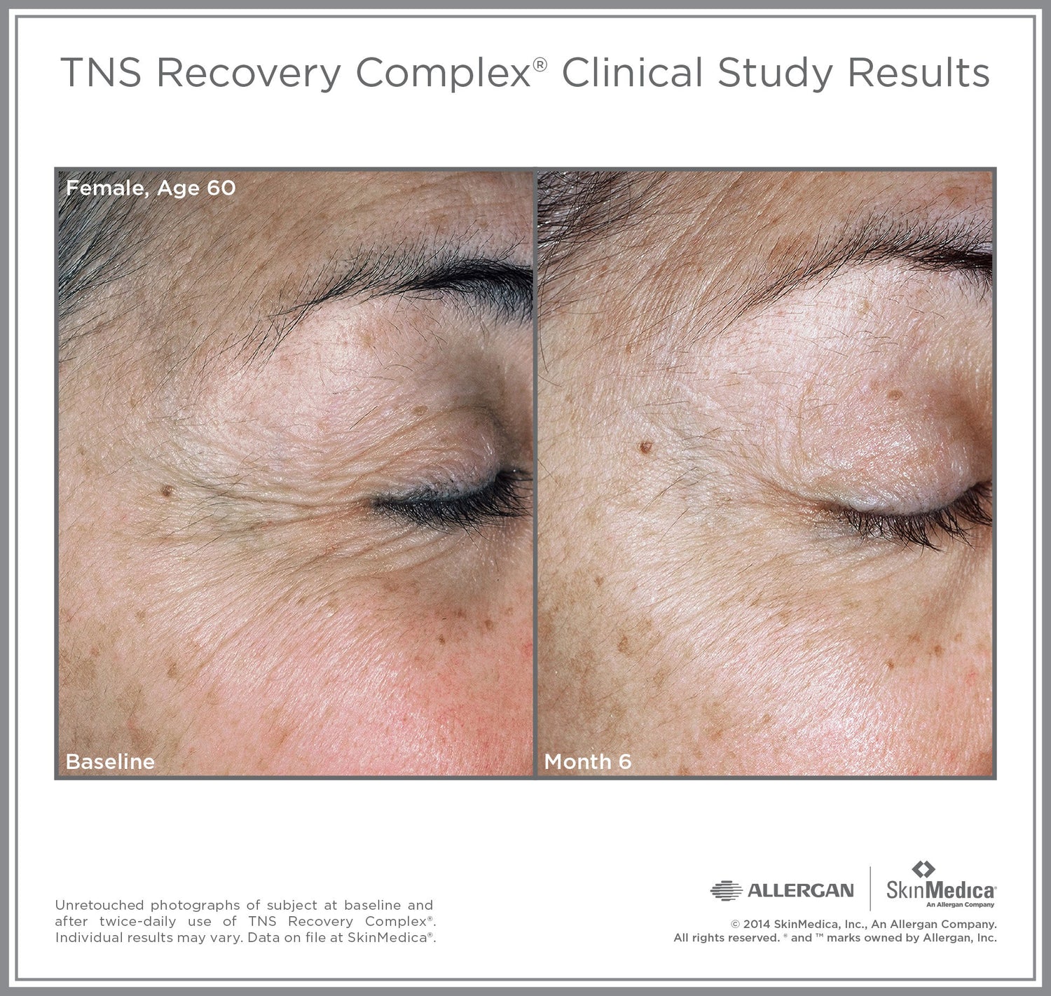 Model image of SkinMedica TNS Recovery Complex