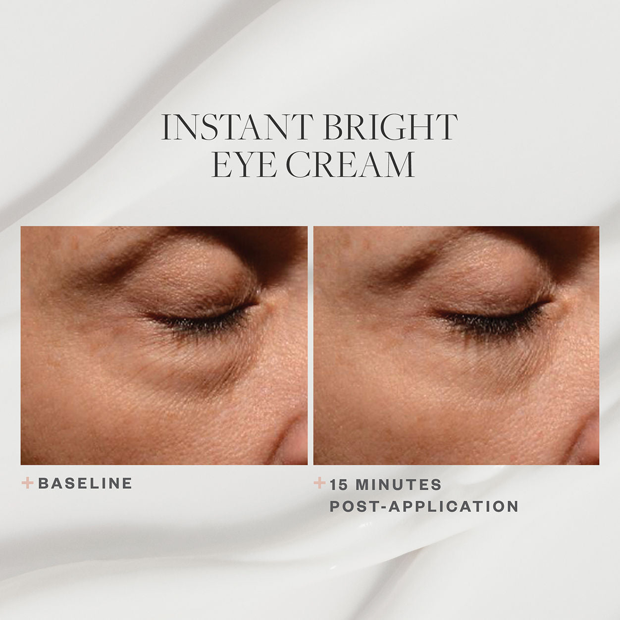 Before and after results of using SkinMedica Instant Bright Eye Cream