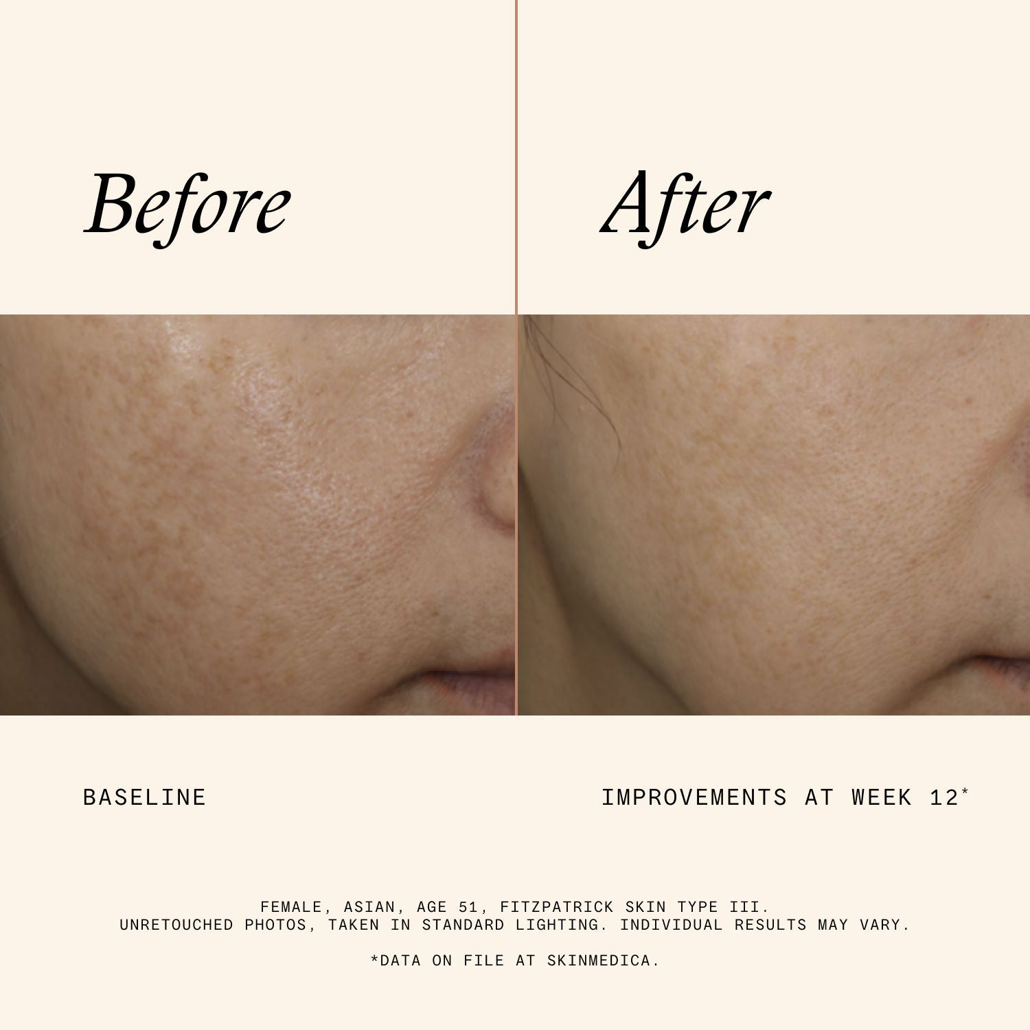Information related to SkinMedica Even & Correct Advanced Brightening Treatment