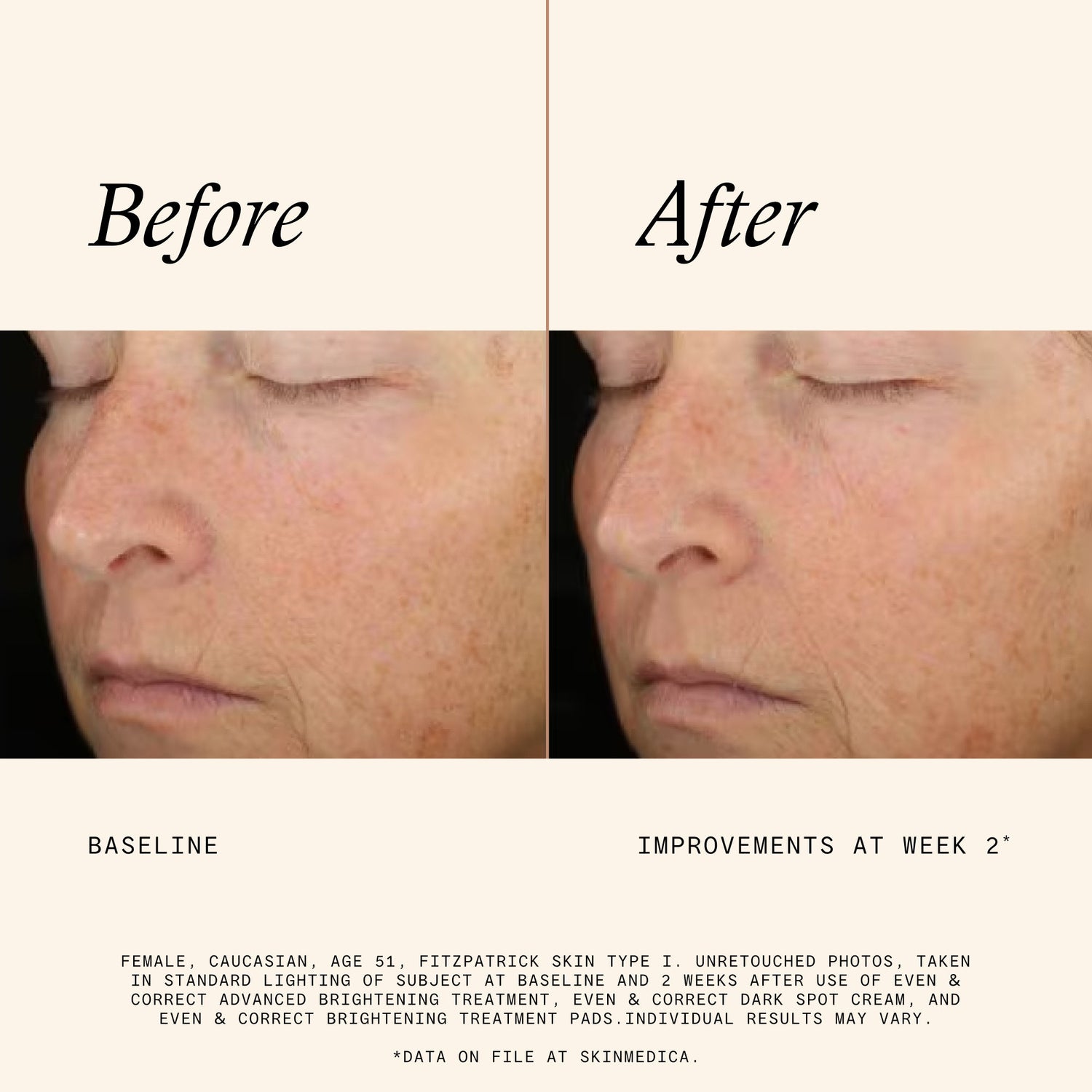 Information related to SkinMedica Even & Correct Brightening Treatment Pads