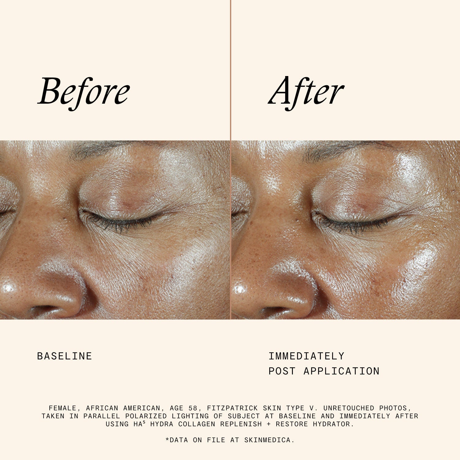 Information related to SkinMedica HA⁵ Hydra Collagen Hydrator with Vegan Collagen