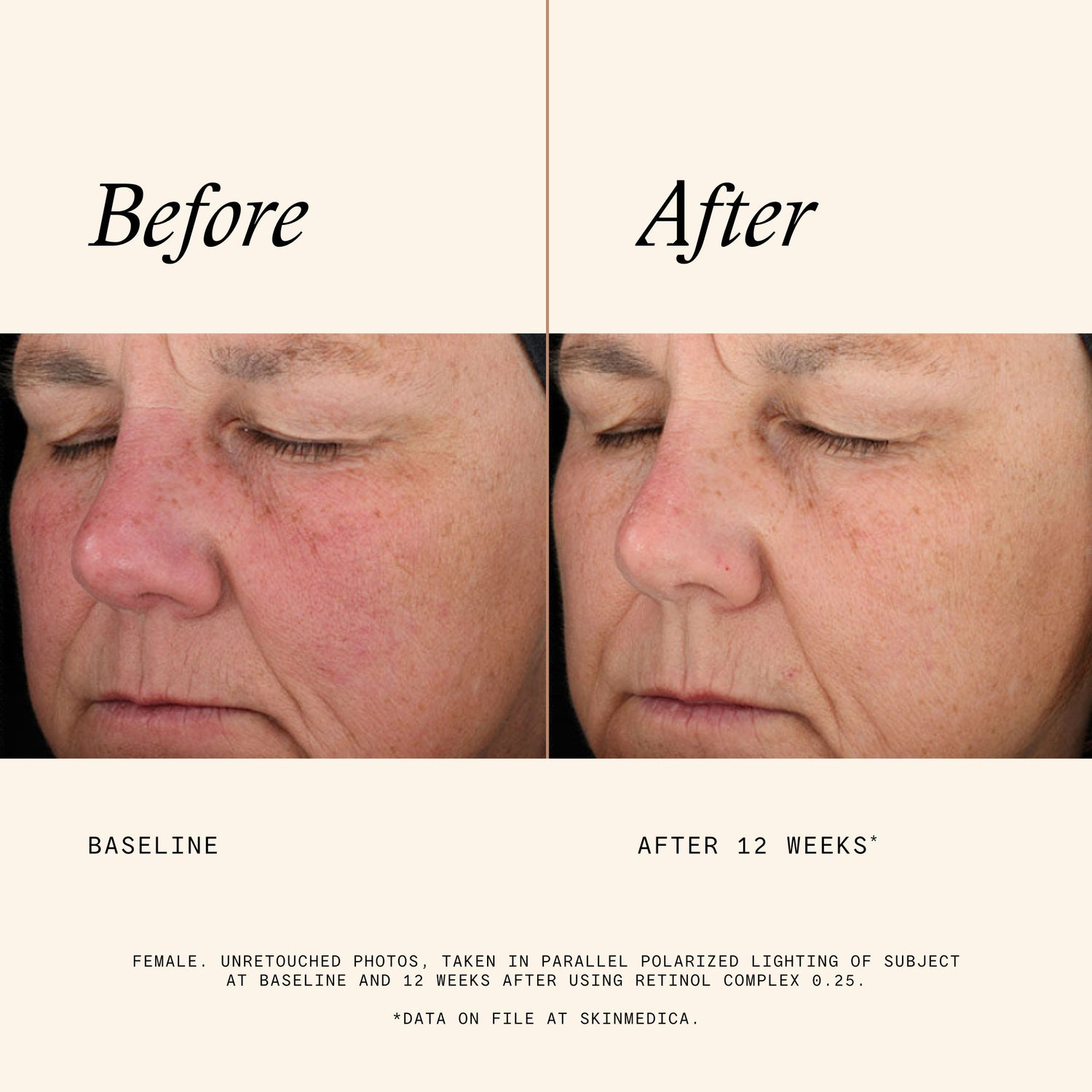 Information related to SkinMedica Retinol Complex 0.25