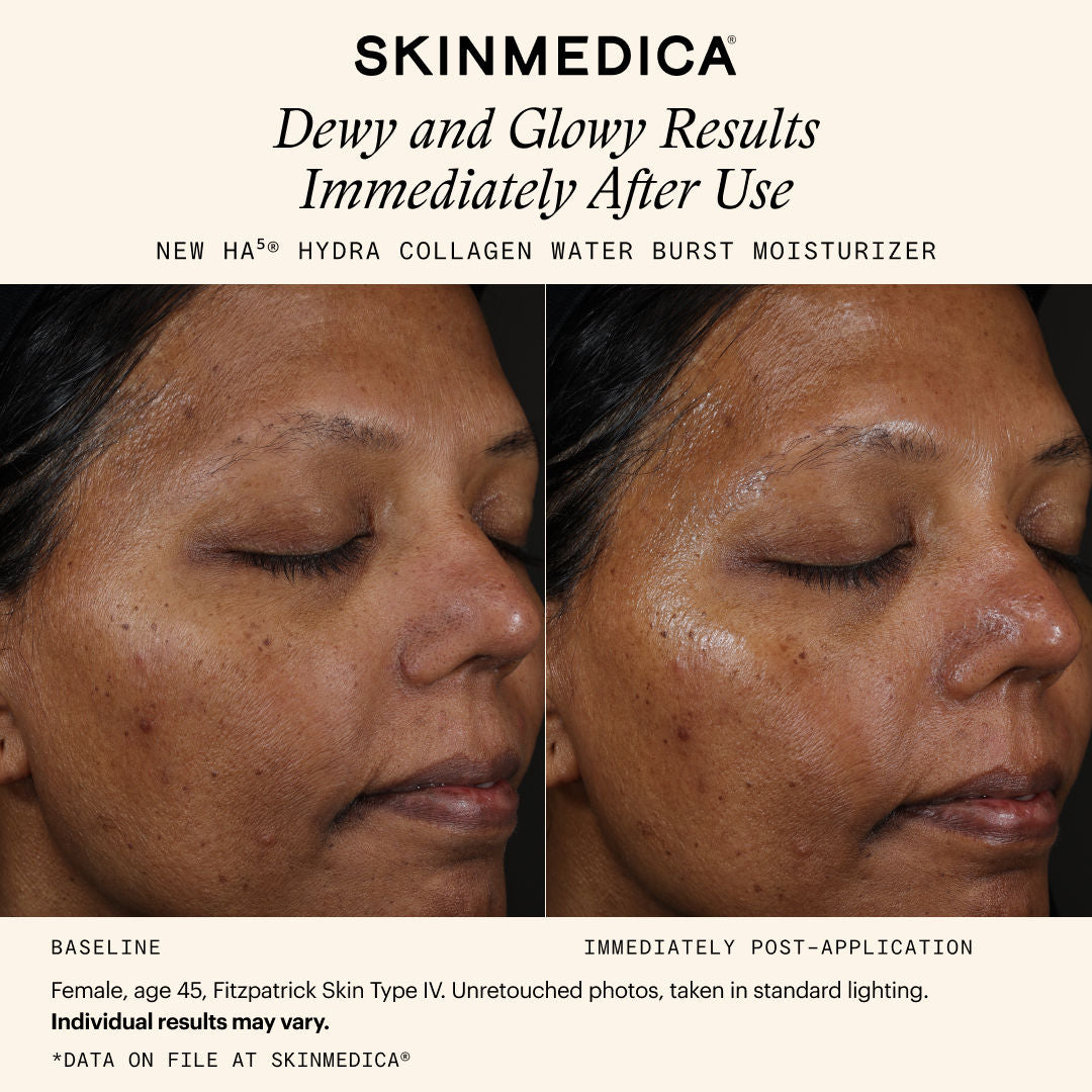 Information related to SkinMedica HA5 Hydra Collagen Water Burst Moisturizer with Vegan Collagen