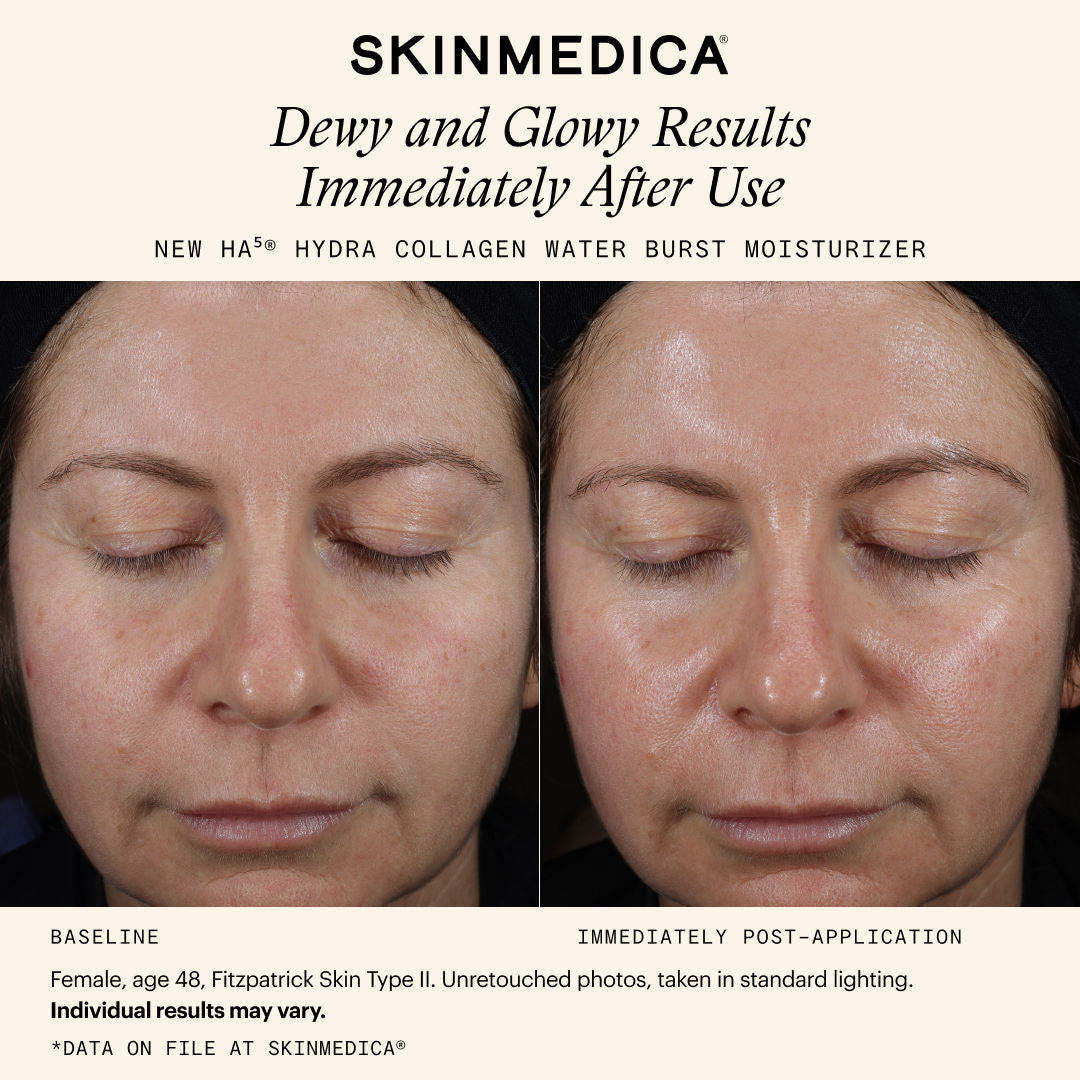 Information related to SkinMedica HA5 Hydra Collagen Water Burst Moisturizer with Vegan Collagen