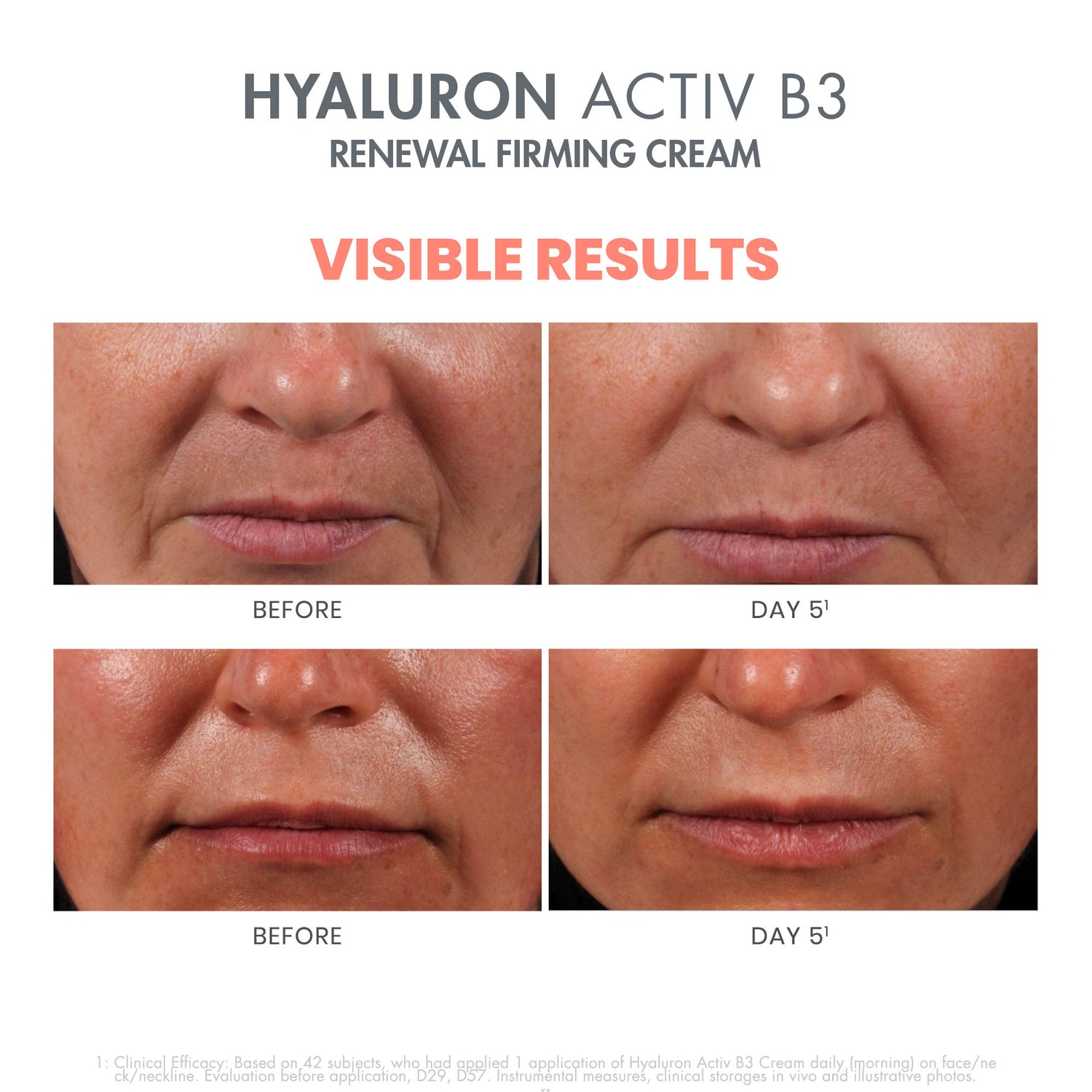 Before and after results of using Avène Hyaluron Activ B3 Renewal Firming Cream
