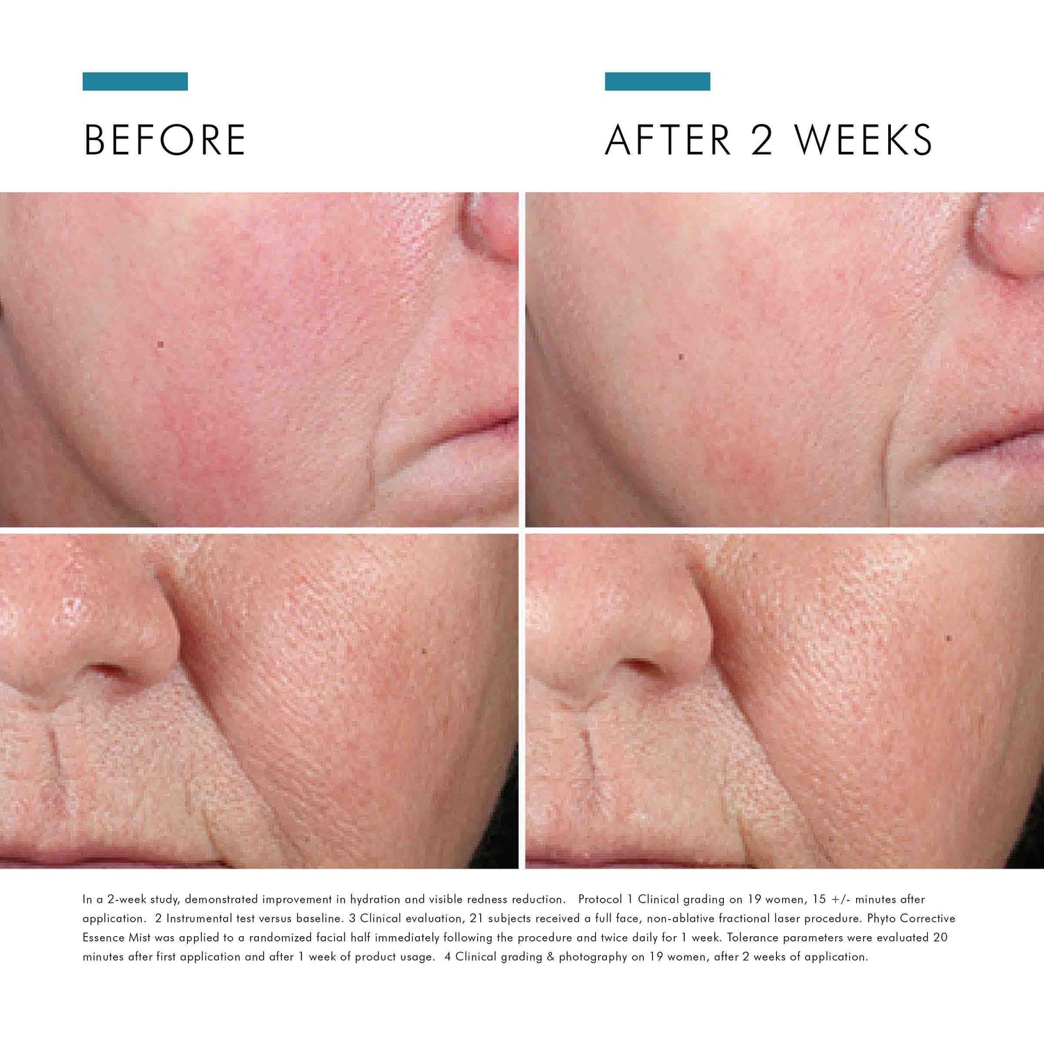 Before and after results of using SkinCeuticals Phyto Corrective Essence Mist