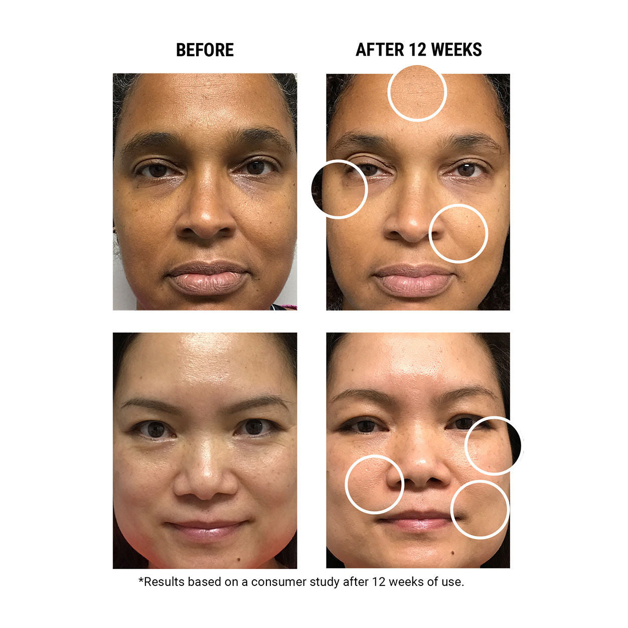 Lifestyle image of Kiehl's Since 1851 Micro-Dose Anti-Aging Retinol Serum With Ceramides and Peptide