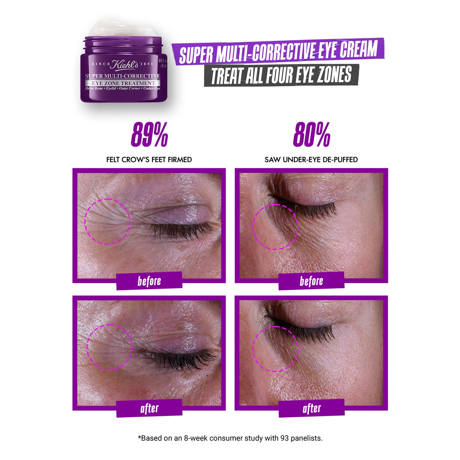 Before and after results of using Kiehl's Since 1851 Super Multi-Corrective Anti-Aging Eye Cream