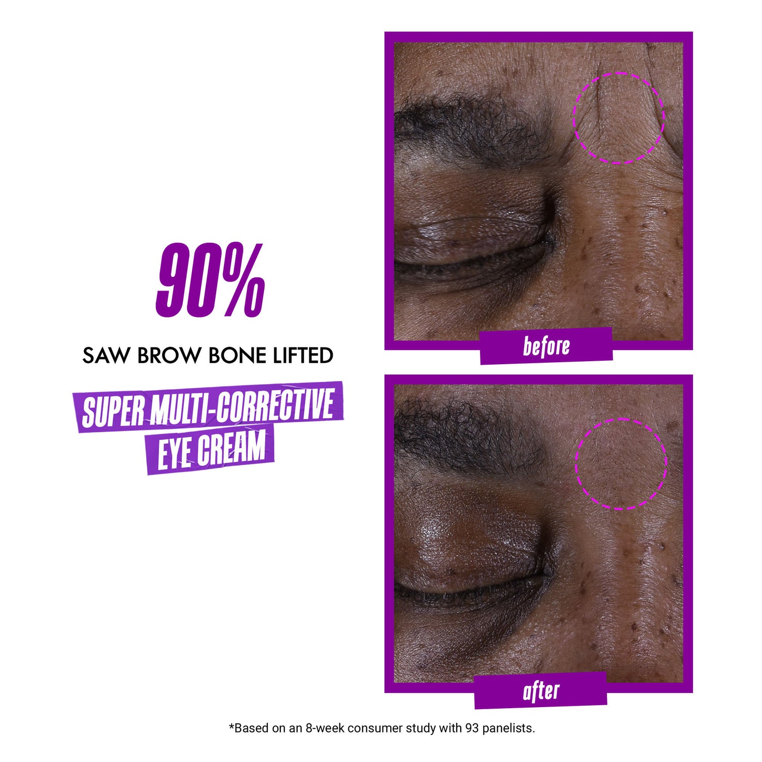 Before and after results of using Kiehl's Since 1851 Super Multi-Corrective Anti-Aging Eye Cream