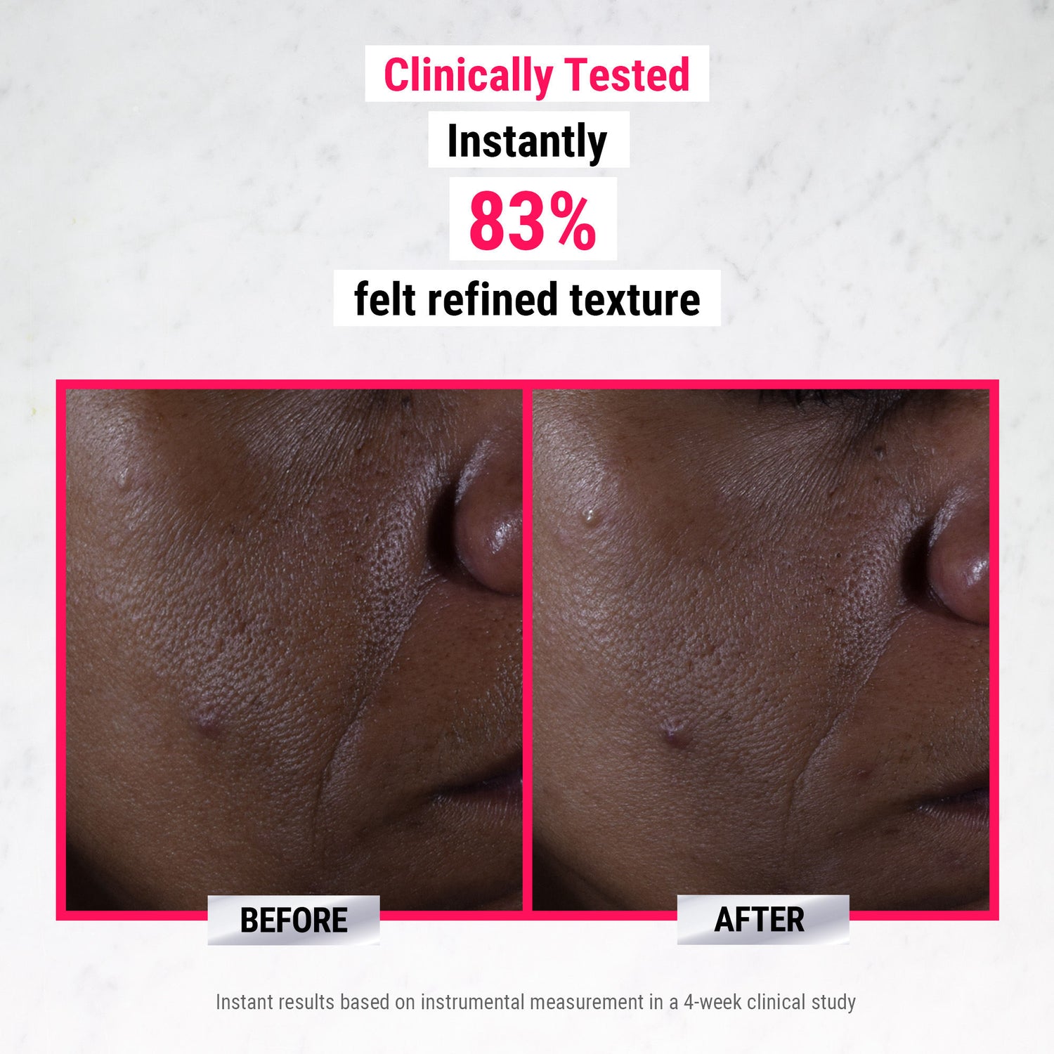 Before and after results of using Kiehl's Since 1851 Ultra Pure High-Potency 9.8% Glycolic Acid Serum
