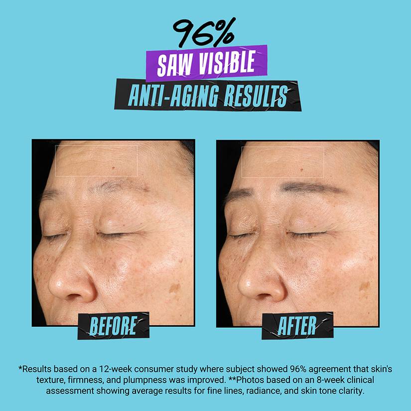 Before and after results of using Kiehl's Since 1851 Super Multi-Corrective Soft Cream