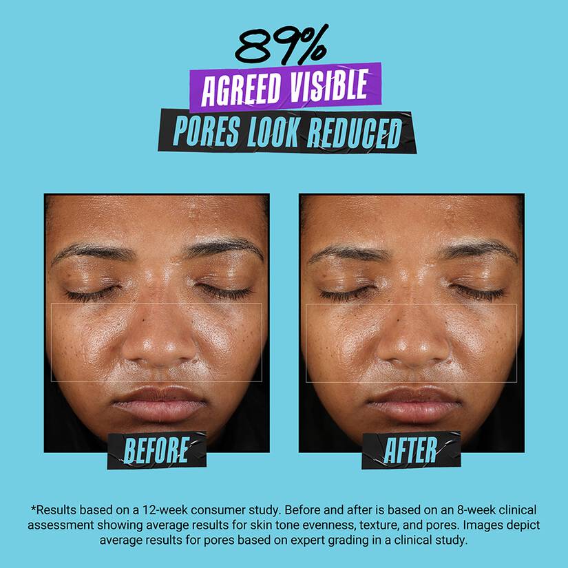 Before and after results of using Kiehl's Since 1851 Super Multi-Corrective Soft Cream