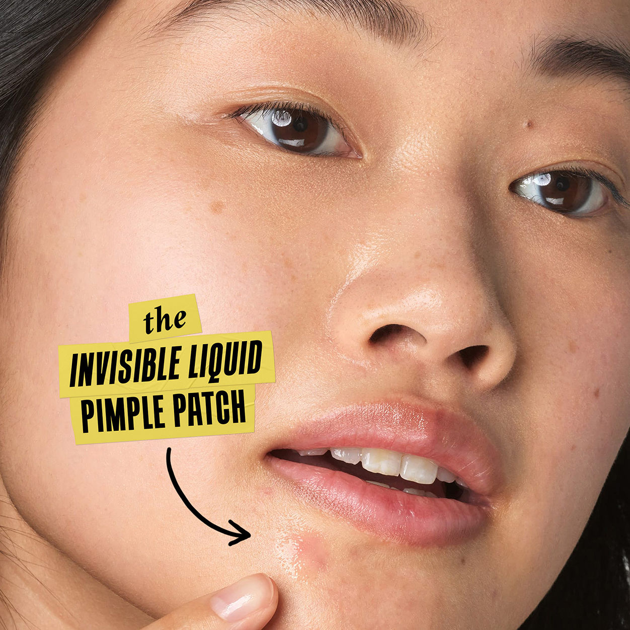 Model image of Kiehl's Since 1851 Truly Targeted Acne-Clearing Solution