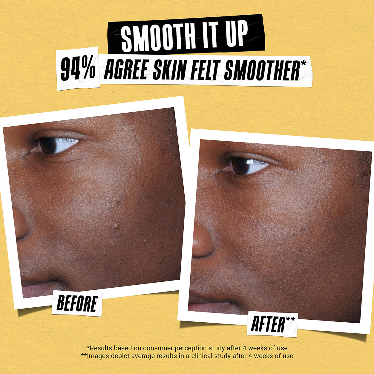 Before and after results of using Kiehl's Since 1851 Better Screen UV Serum SPF 50+