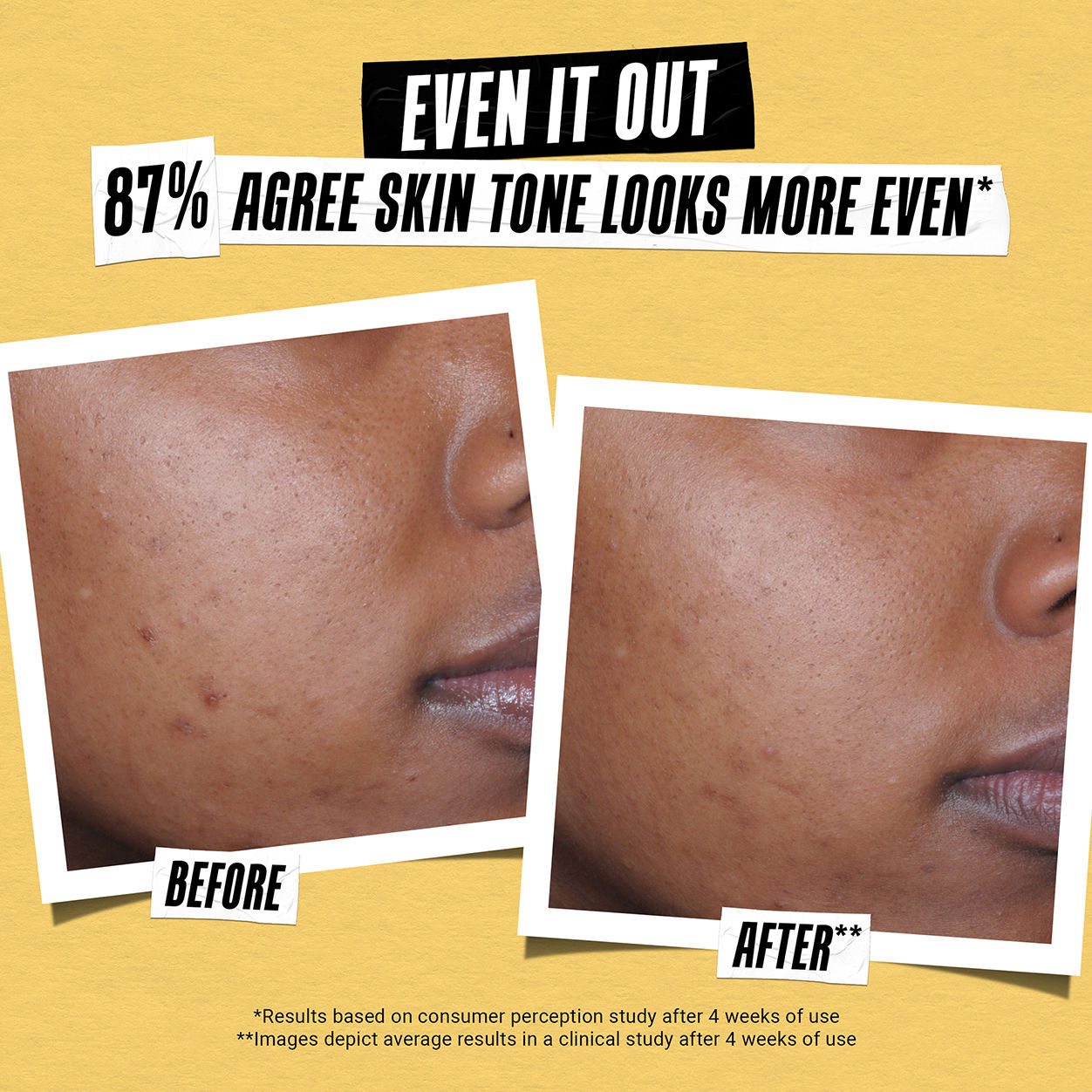 Before and after results of using Kiehl's Since 1851 Better Screen UV Serum SPF 50+