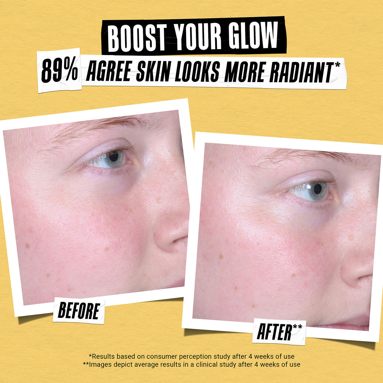 Before and after results of using Kiehl's Since 1851 Better Screen UV Serum SPF 50+