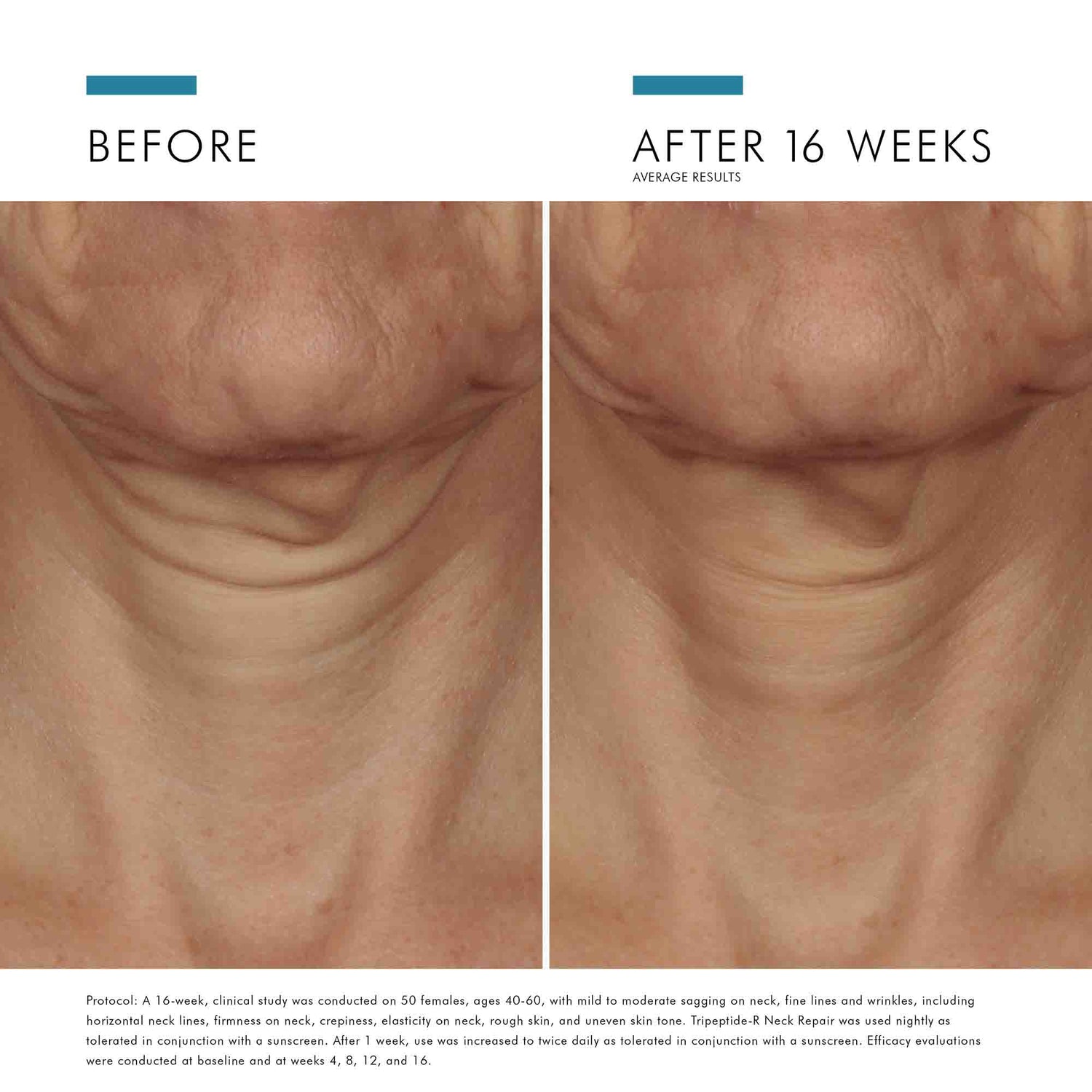 Image of product in the same collection as SkinCeuticals Tripeptide-R Neck Repair