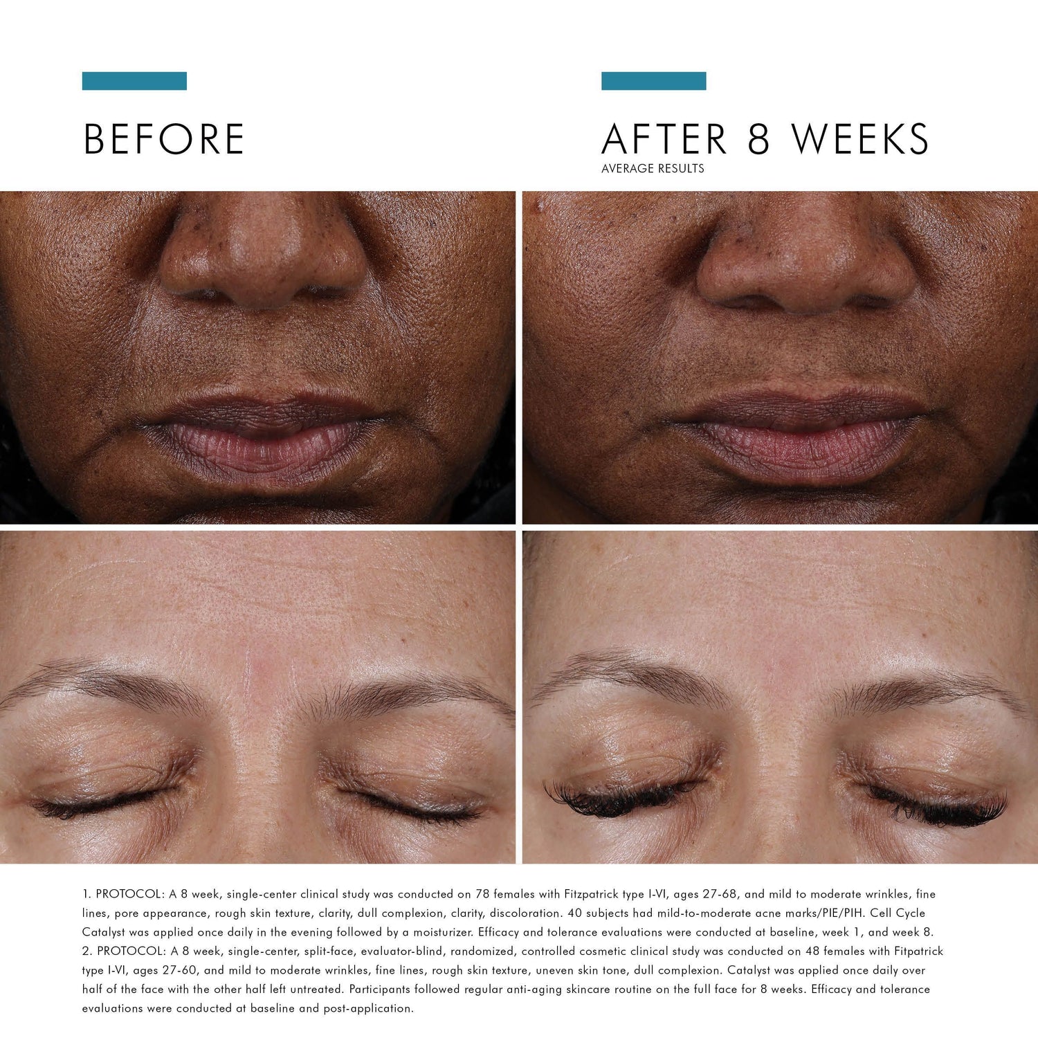 Before and after results of using SkinCeuticals Cell Cycle Catalyst