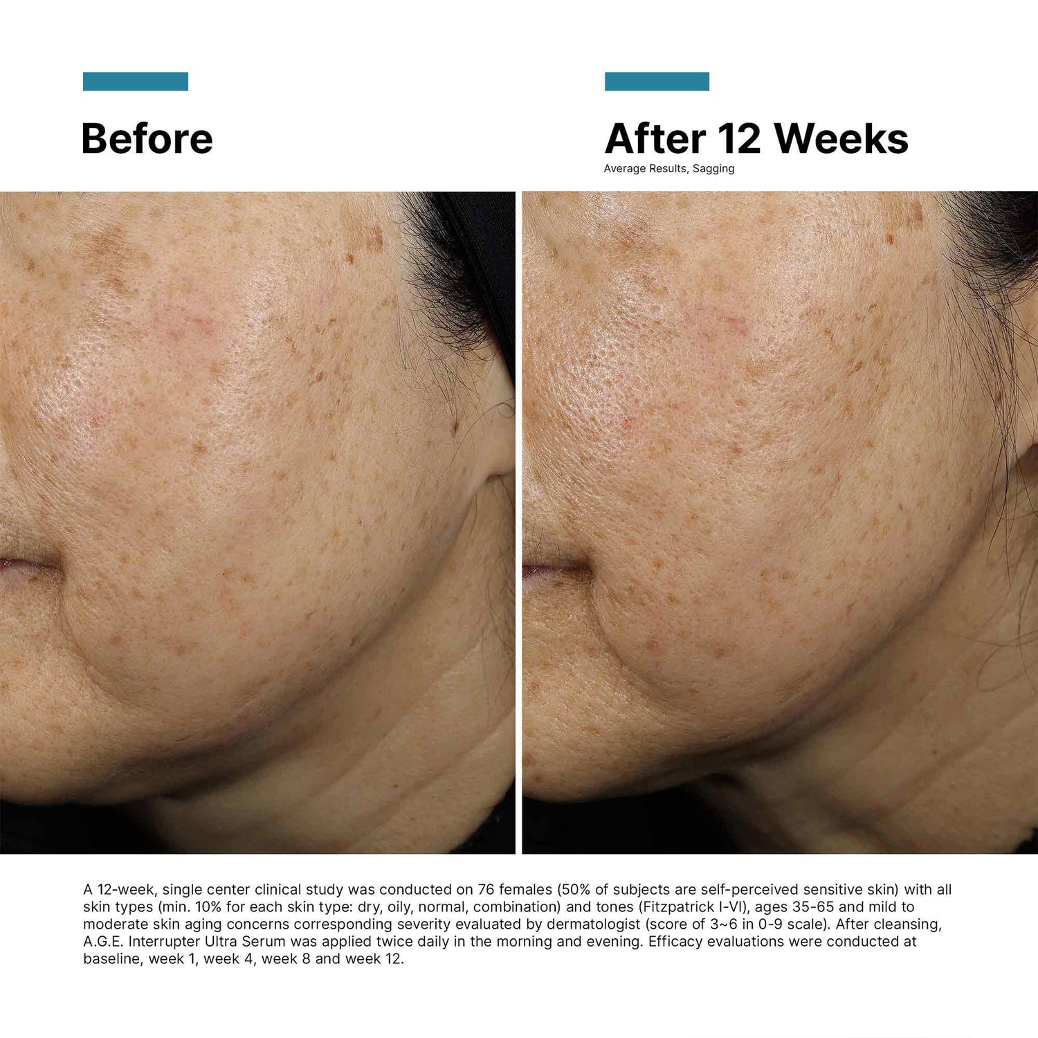 Image of product in the same collection as SkinCeuticals A.G.E. Interrupter Ultra Lifting Serum