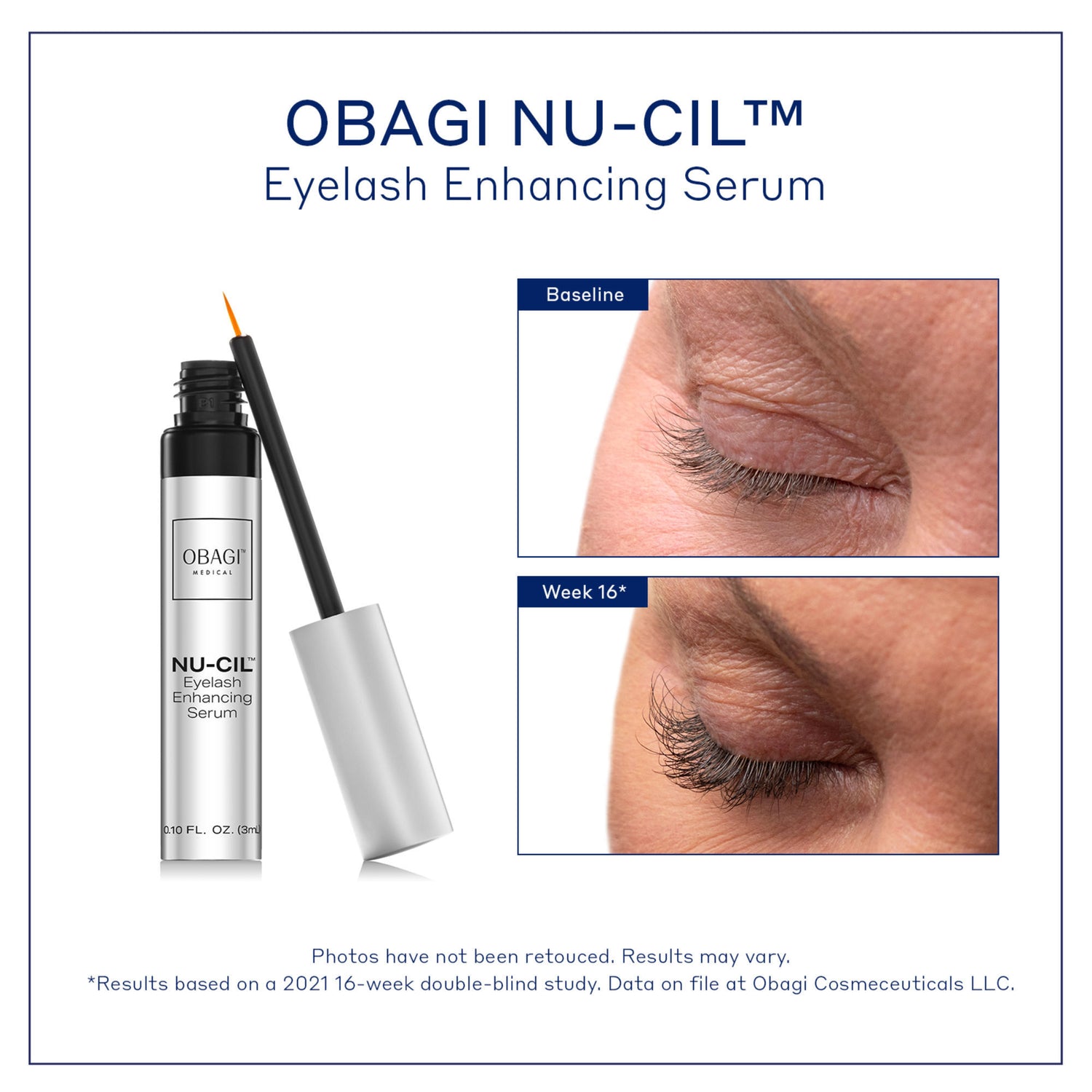 Before and after results of using Obagi Nu-Cil Eyelash Enhancing Serum