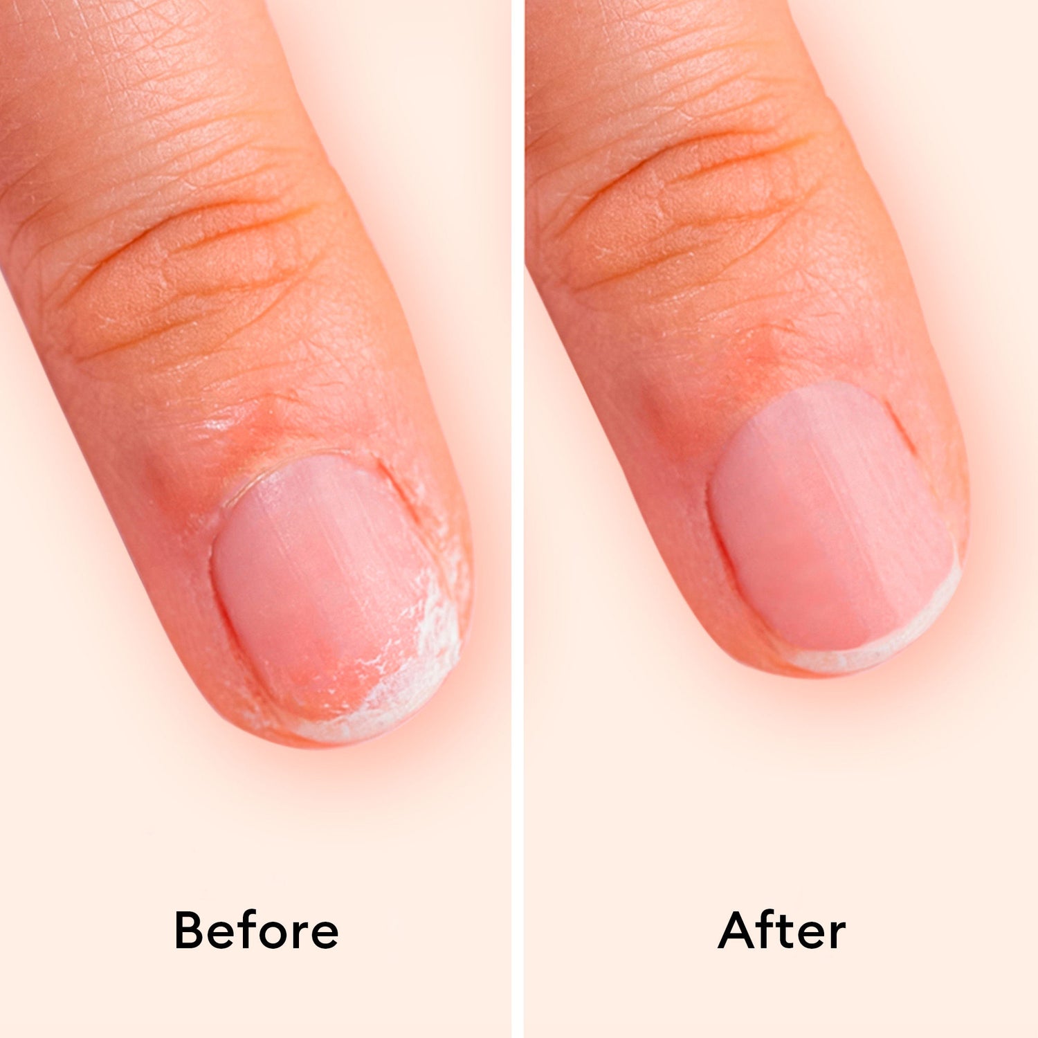 Before and after results of using Manucurist Day and Night Duo