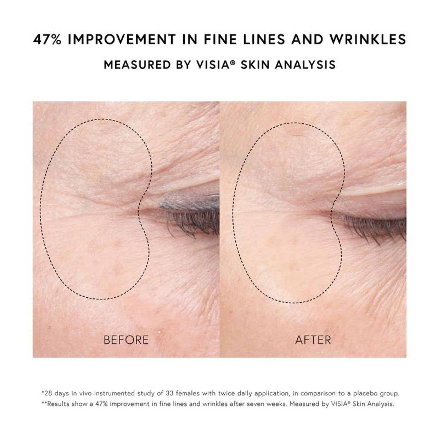 Lifestyle image of Dr. Barbara Sturm Super Anti-Aging Eye Serum