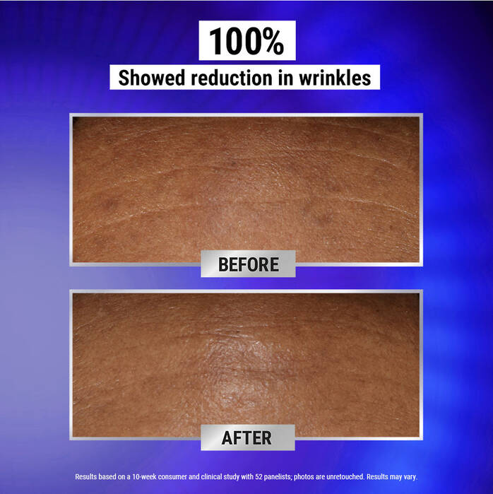 Before and after results of using Kiehl's Since 1851 Fast Release Wrinkle-Reducing 0.3% Retinol Night Serum