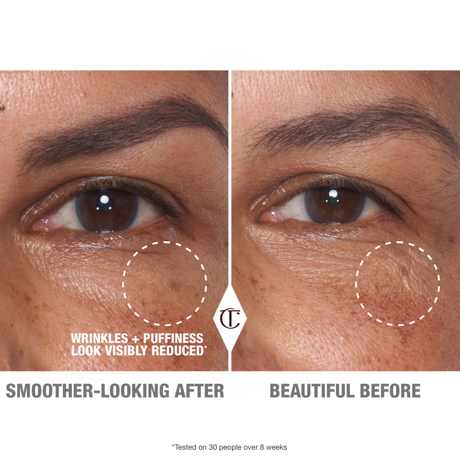 Before and after results of using Charlotte Tilbury Cryo Recovery Eye Serum