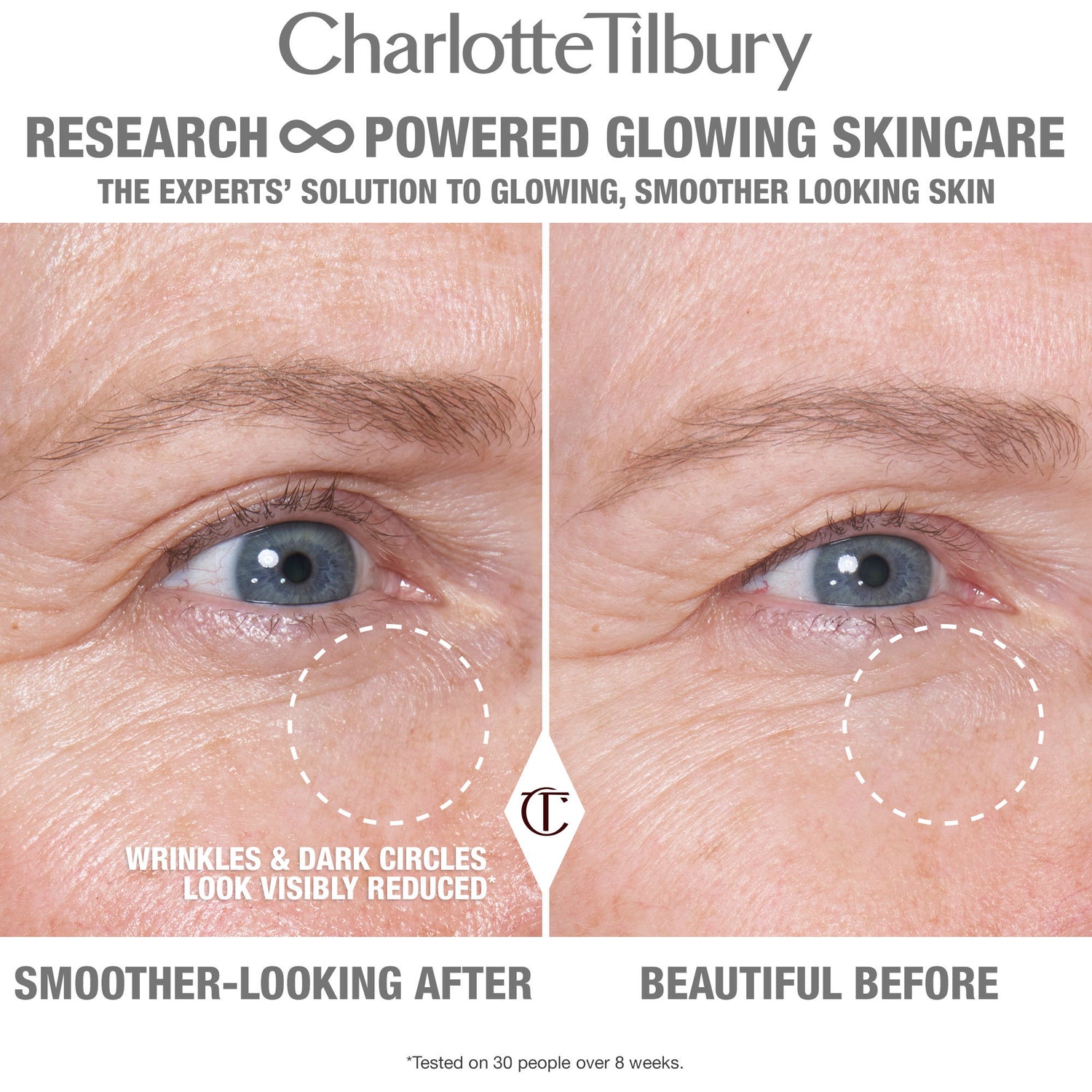 Before and after results of using Charlotte Tilbury Cryo Recovery Eye Serum