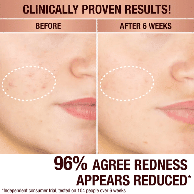 Before and after results of using Charlotte Tilbury Dark Spot Correcting Radiance Recovery Serum