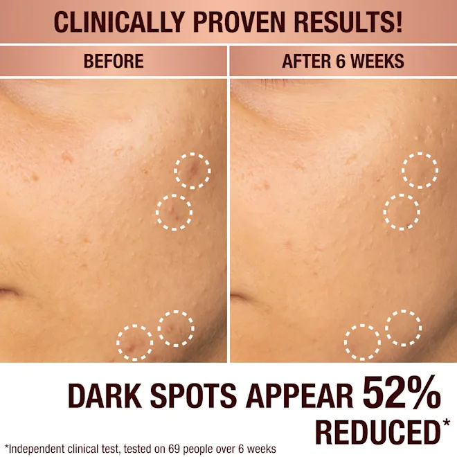 Before and after results of using Charlotte Tilbury Dark Spot Correcting Radiance Recovery Serum