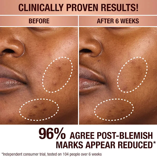 Before and after results of using Charlotte Tilbury Dark Spot Correcting Radiance Recovery Serum