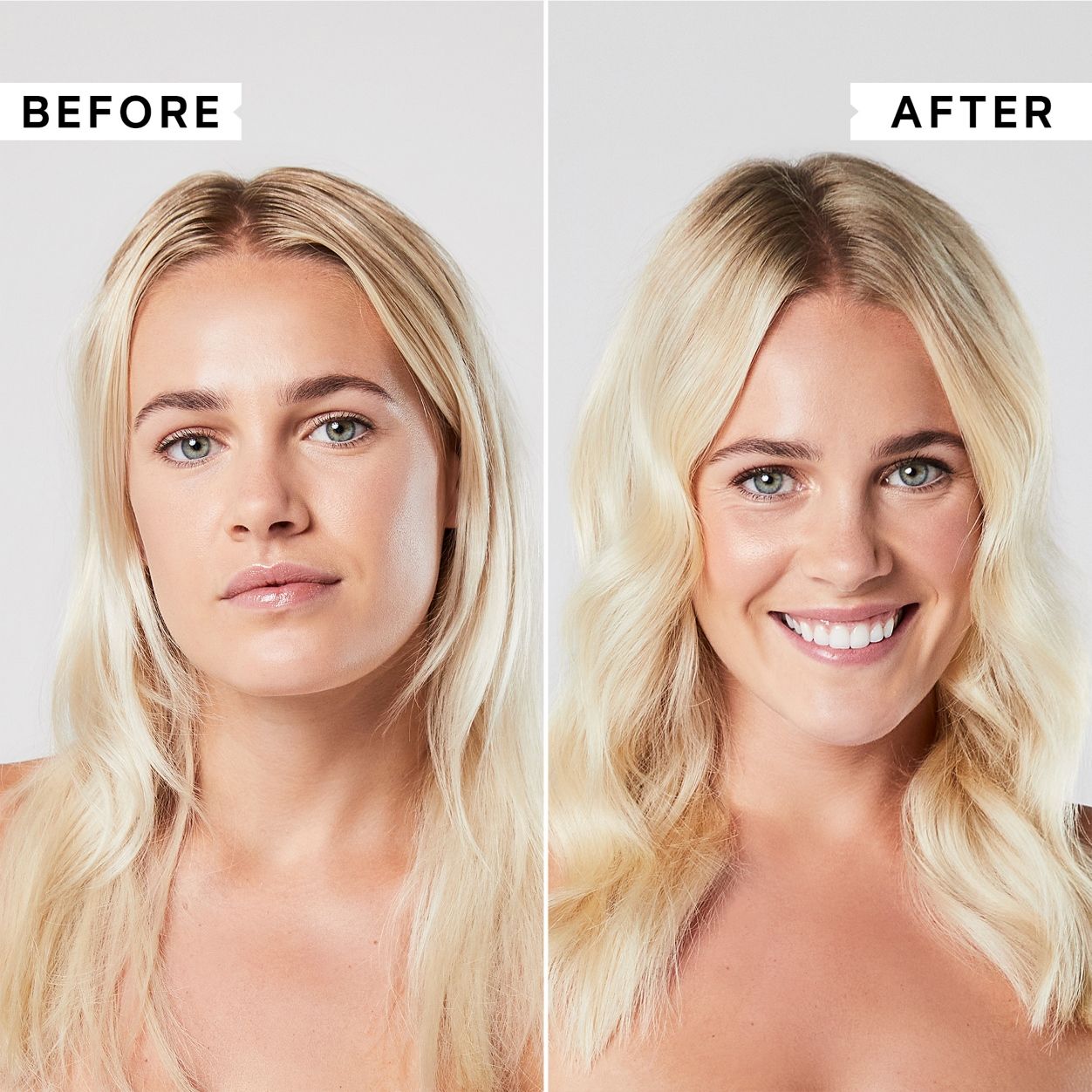 Before and after results of using Philip Kingsley Flaky Scalp Hydrating Conditioner