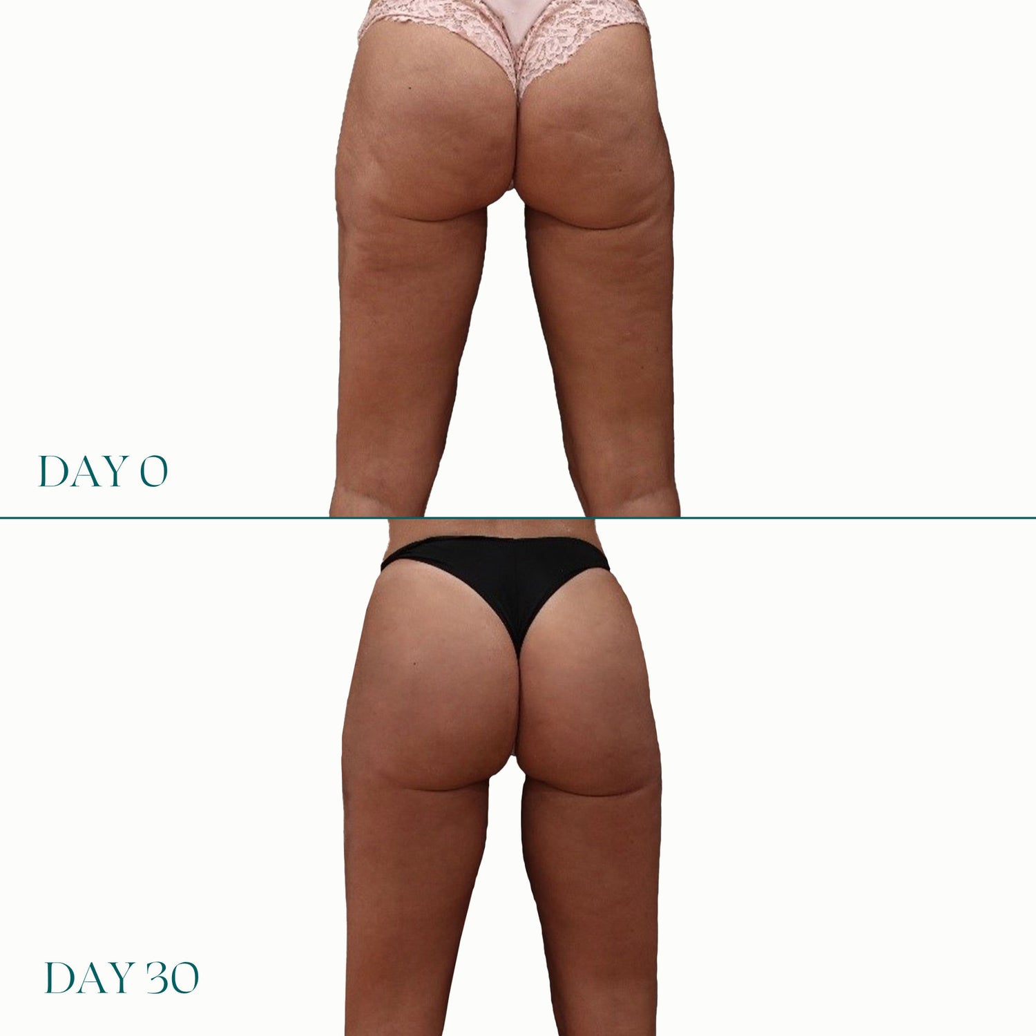Before and after results of using Legology Peach-Lite Super Lift For The Derriere
