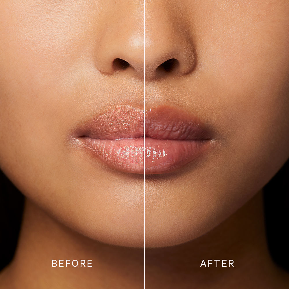 Before and after results of using MZ Skin Volumizing Lip Perfector
