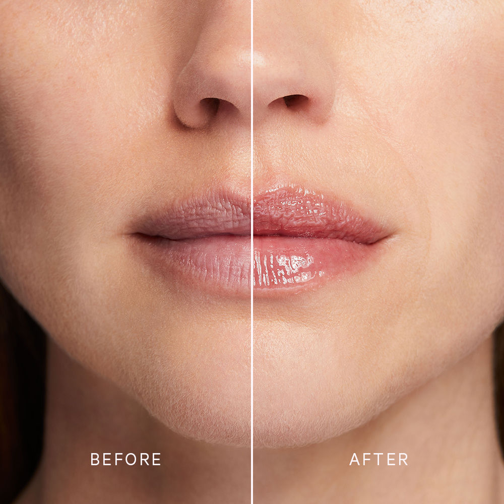 Before and after results of using MZ Skin Volumizing Lip Perfector