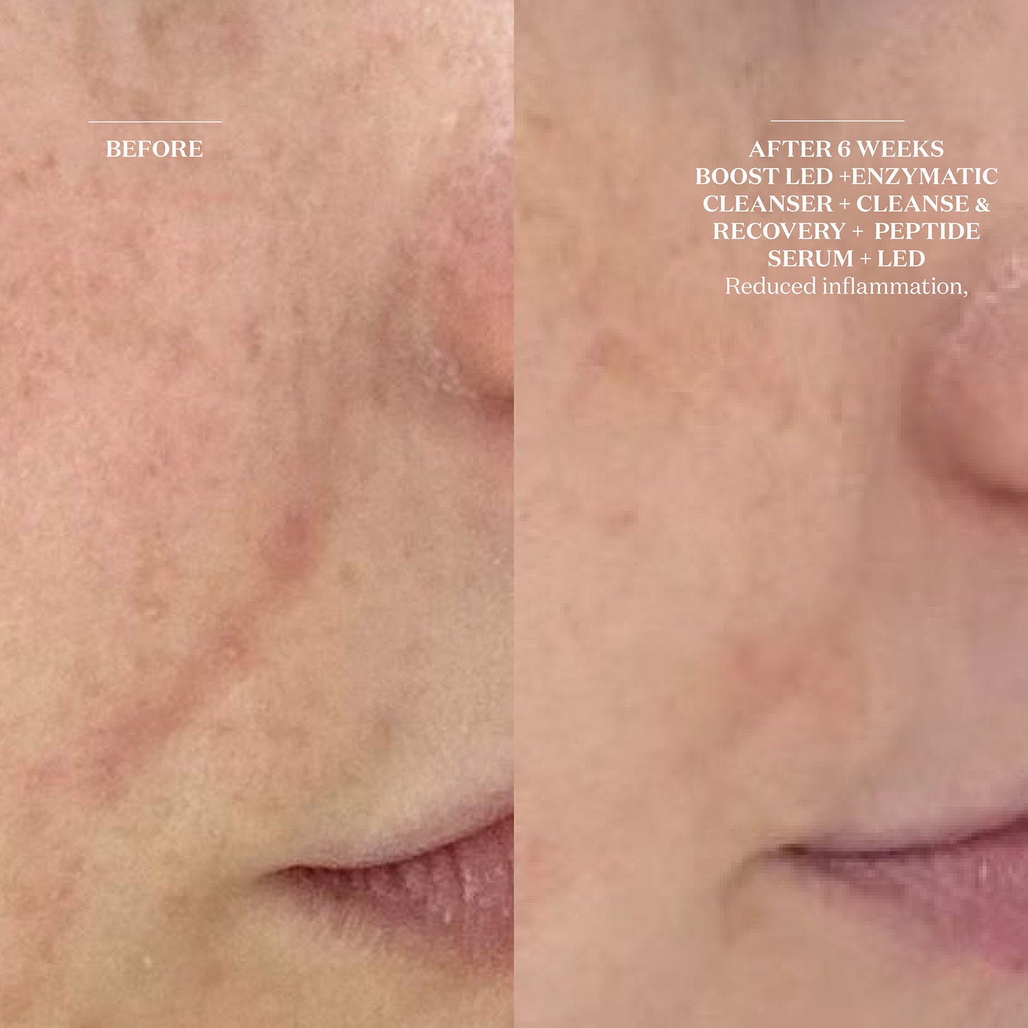 Before and after results of using The Light Salon Cleanse and Recovery Spray