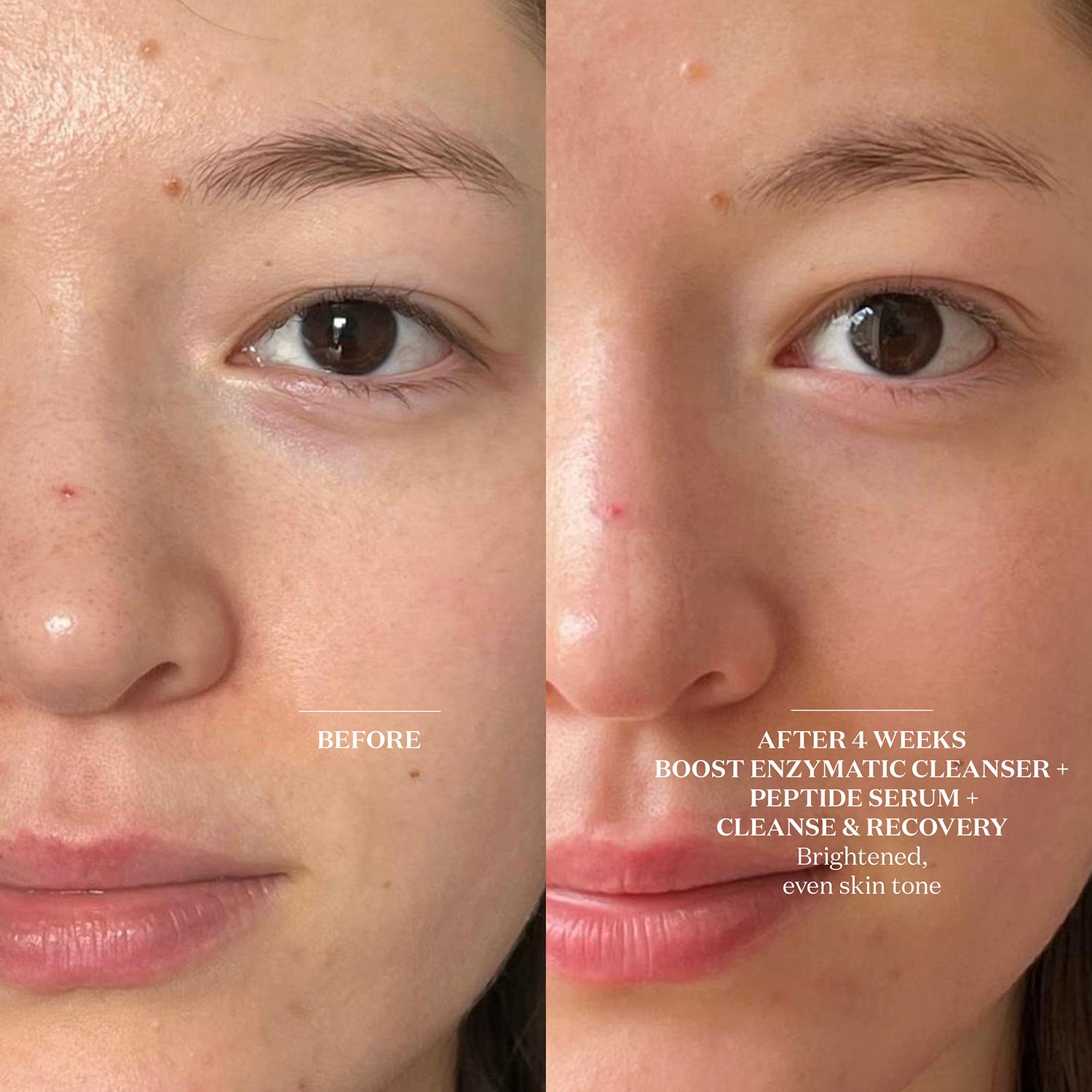 Before and after results of using The Light Salon Cleanse and Recovery Spray