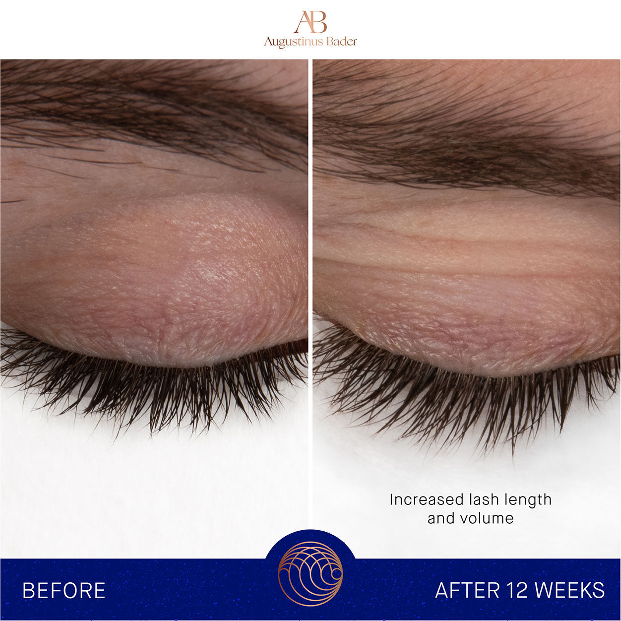 Before and after results of using Augustinus Bader The Eyebrow and Lash Enhancing Serum