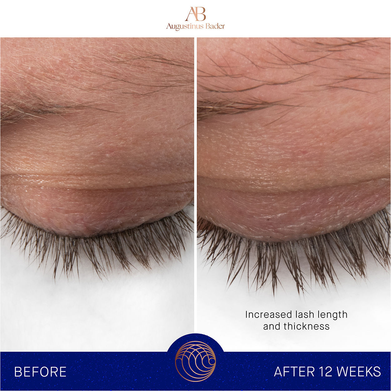 Before and after results of using Augustinus Bader The Eyebrow and Lash Enhancing Serum