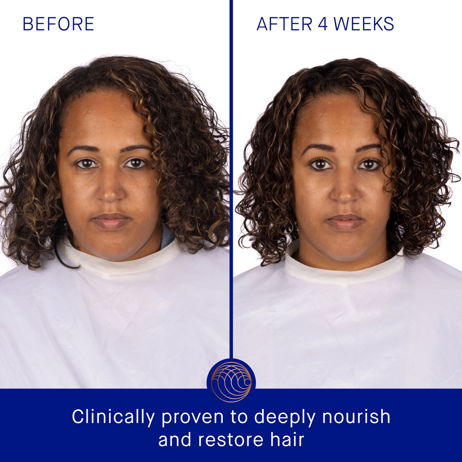 Before and after results of using Augustinus Bader The Rich Shampoo