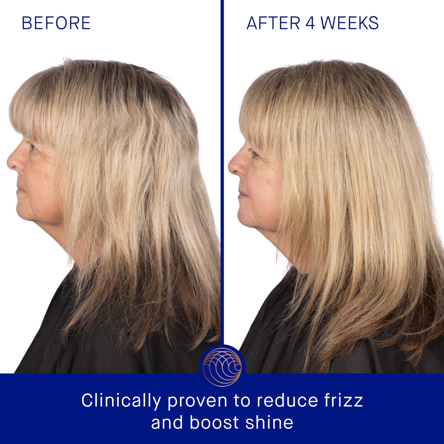 Before and after results of using Augustinus Bader The Rich Shampoo