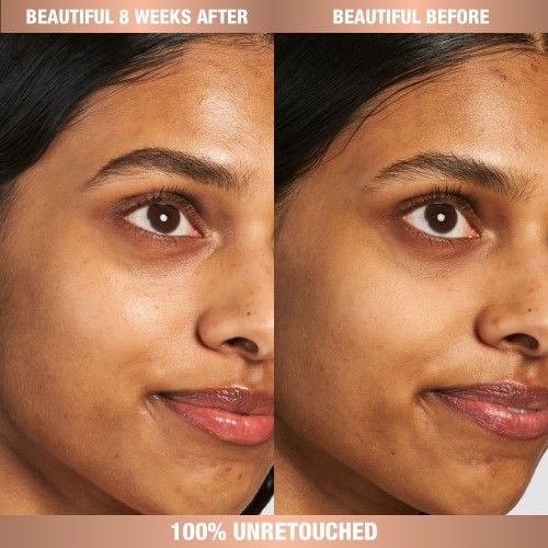 Before and after results of using Charlotte Tilbury Magic Eye Rescue